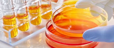 gloved hand holding a petri dish with an orange liquid